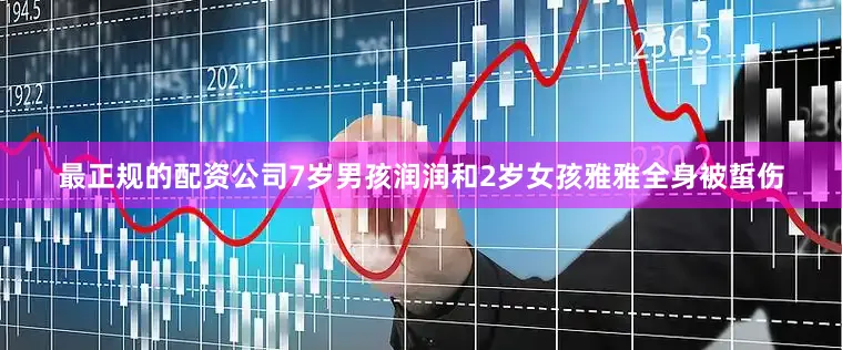 最正规的配资公司7岁男孩润润和2岁女孩雅雅全身被蜇伤